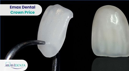 Emax Dental Crown Price