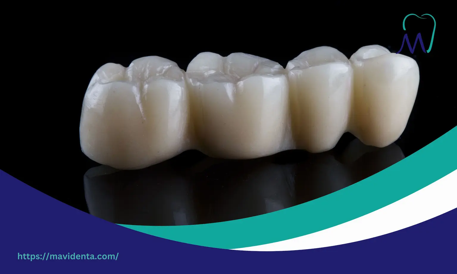 Zirconium Crowns Vs Veneers