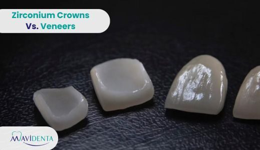 Zirconium Crowns vs. Veneers