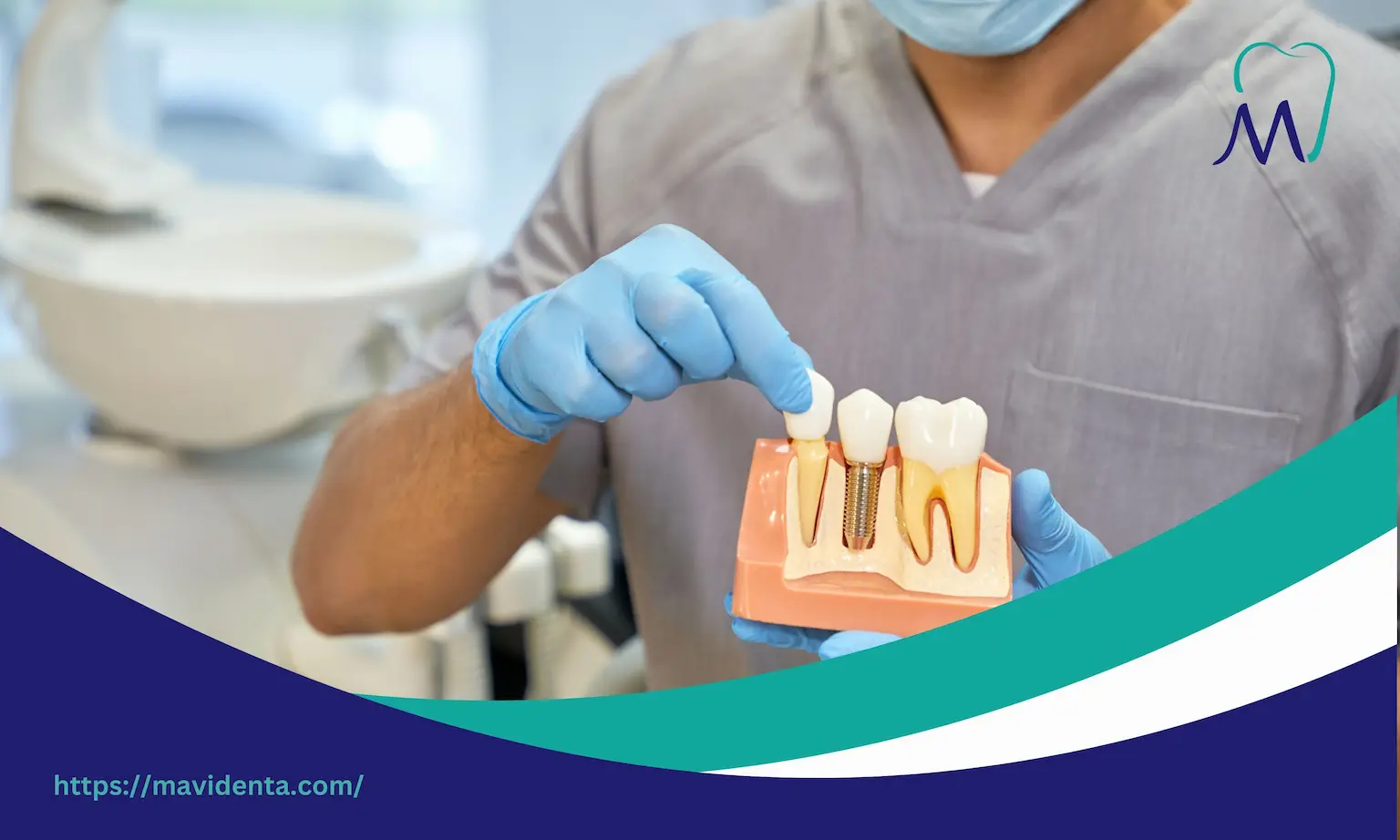 Dental Implants Cost For Whole Mouth  Dental Implants Cost For Whole Mouth
