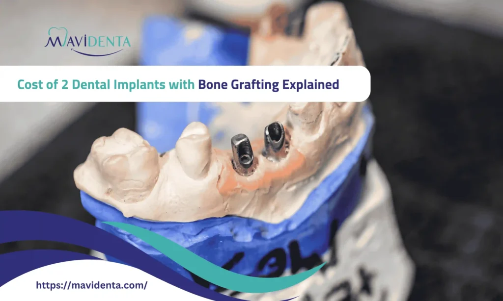 cost of 2 dental implants with bone grafting