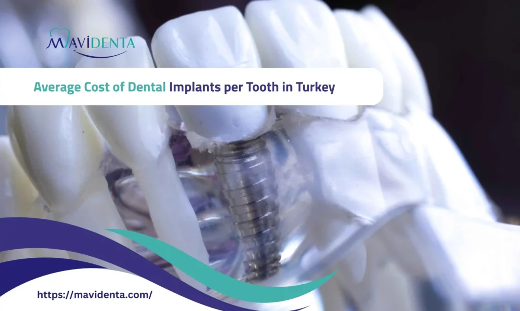 average cost of dental implants per tooth