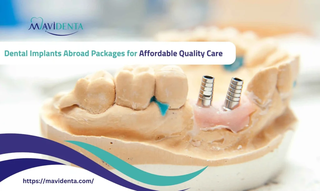 dental implants abroad packages