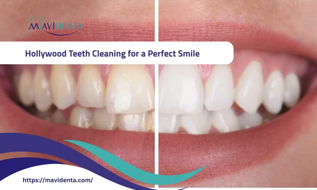 hollywood teeth cleaning