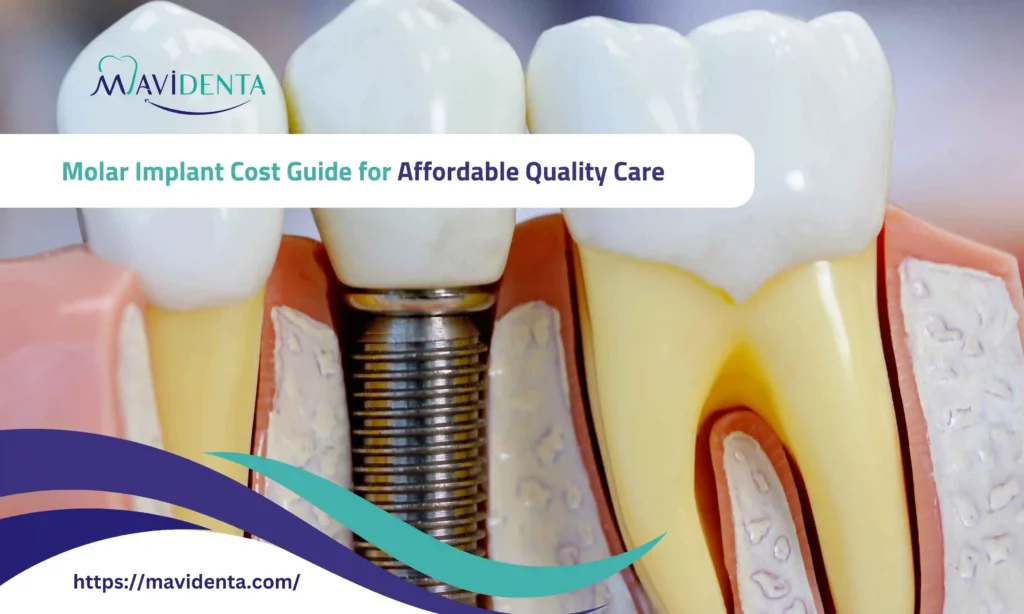 molar implant cost