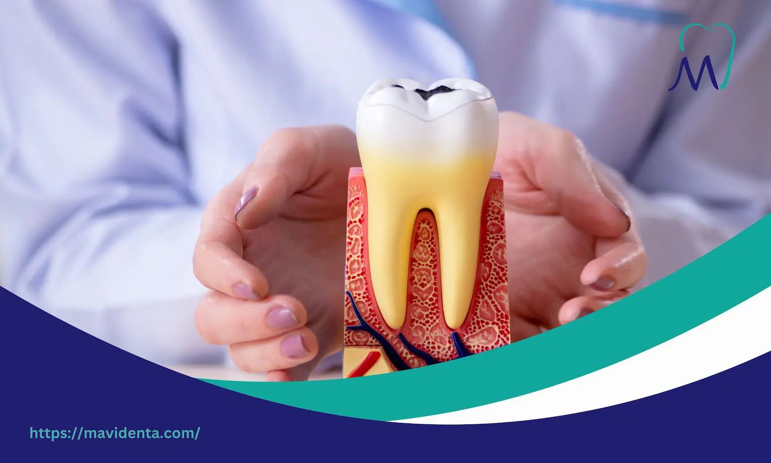 all on 4 dental implants cost with insurance all on 4 dental implants cost with insurance