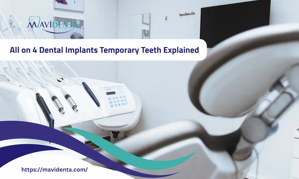 all on 4 dental implants temporary teeth