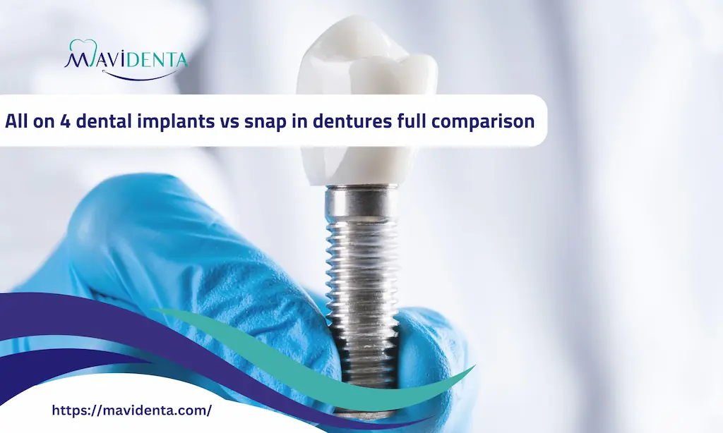 all on 4 dental implants vs snap in dentures