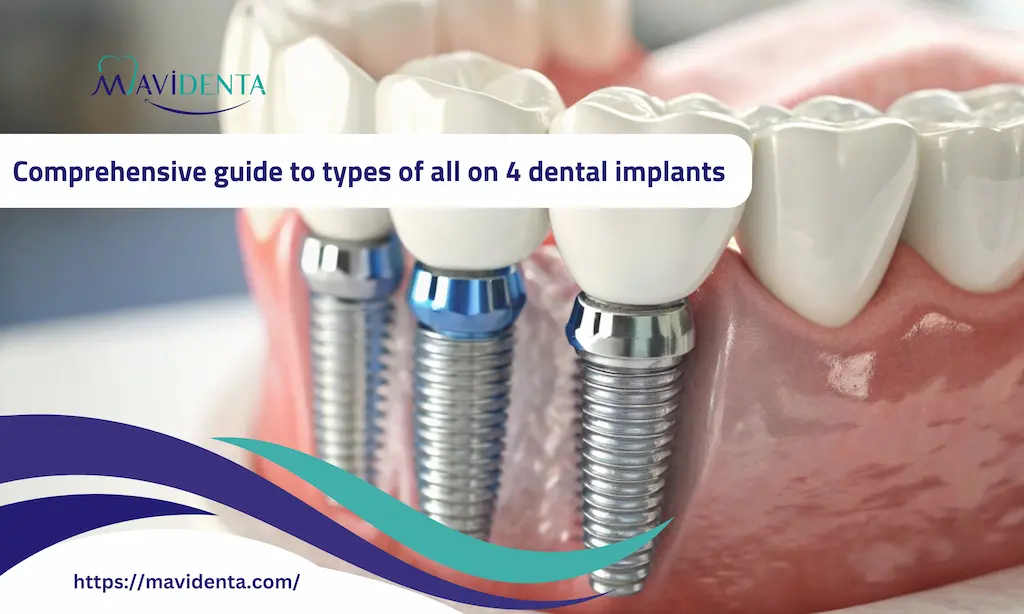 types of all on 4 dental implants