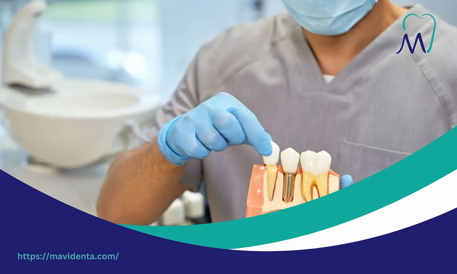 types of all on 4 dental implants types of all on 4 dental implants