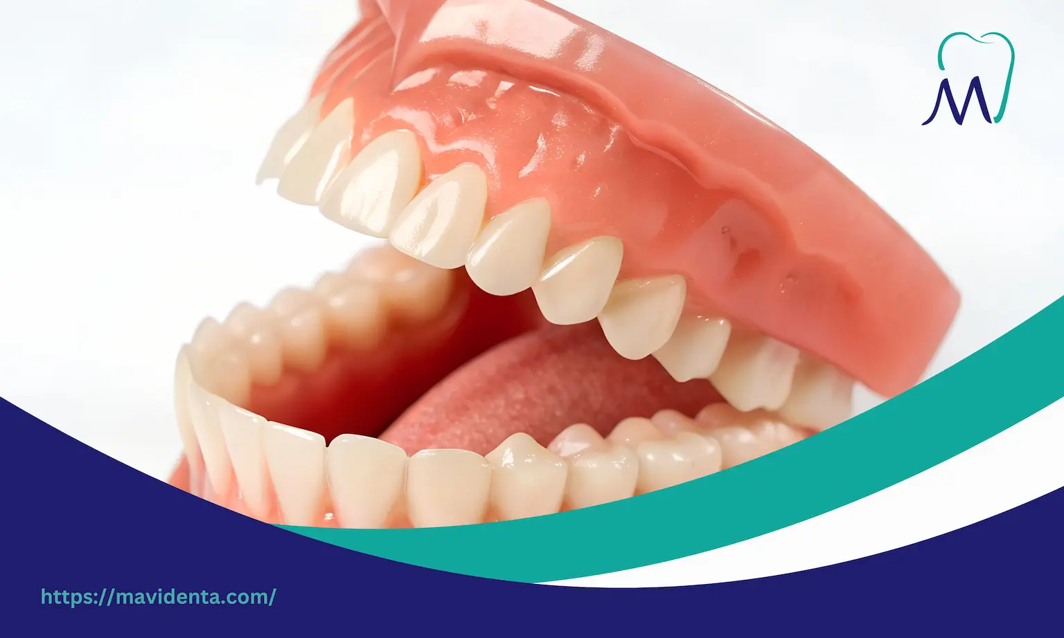 all in one dentures all in one dentures