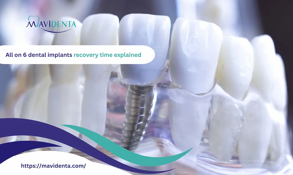 all on 6 dental implants recovery time