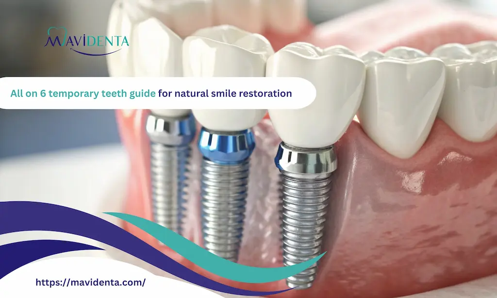 all on 6 temporary teeth
