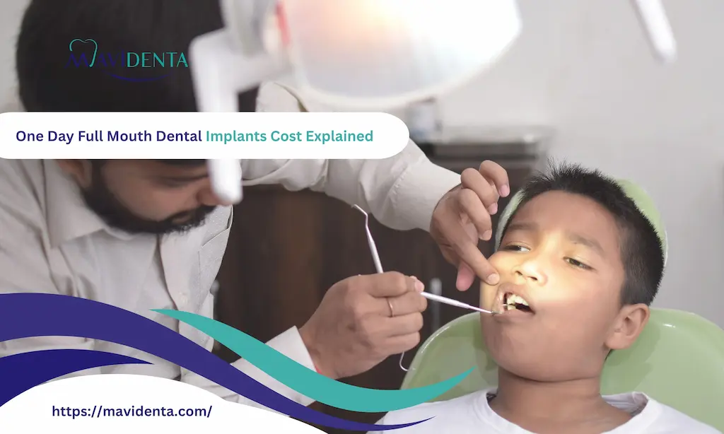 one day full mouth dental implants cost