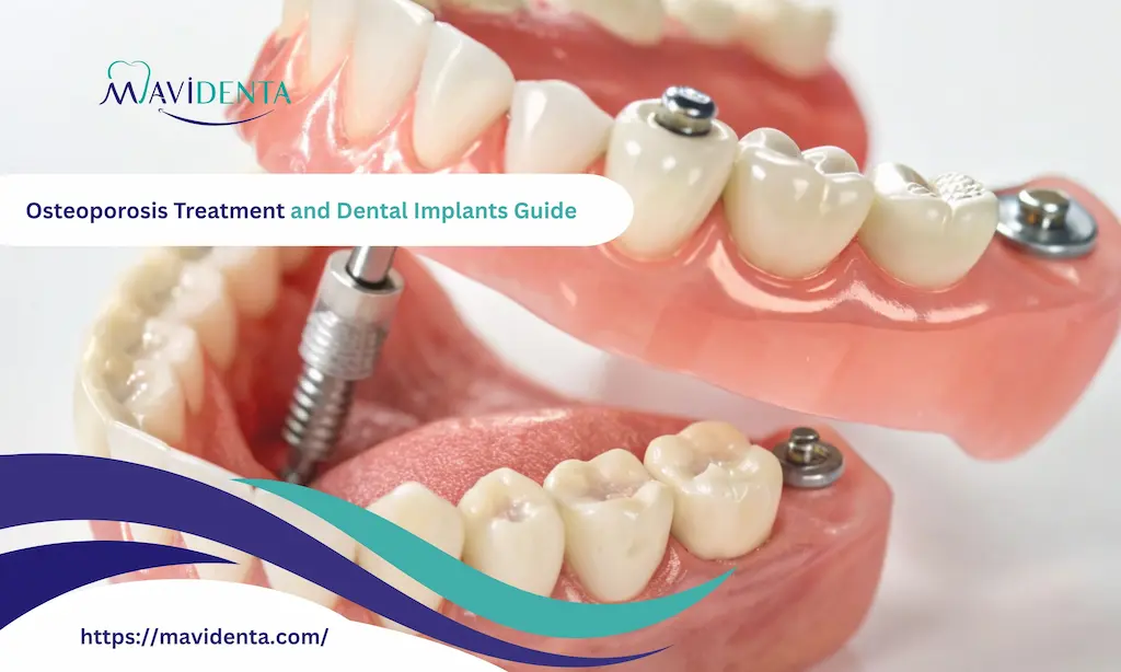 osteoporosis treatment and dental implants