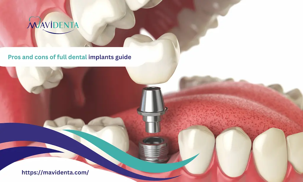 pros and cons of full dental implants