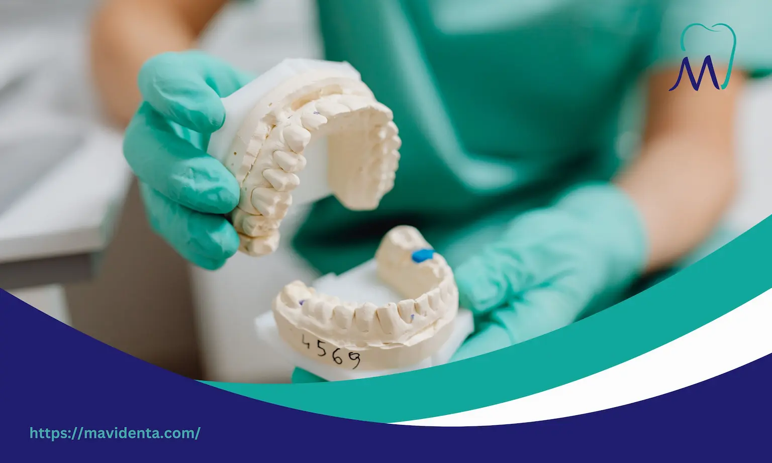 what is better dental implants or dentures what is better dental implants or dentures