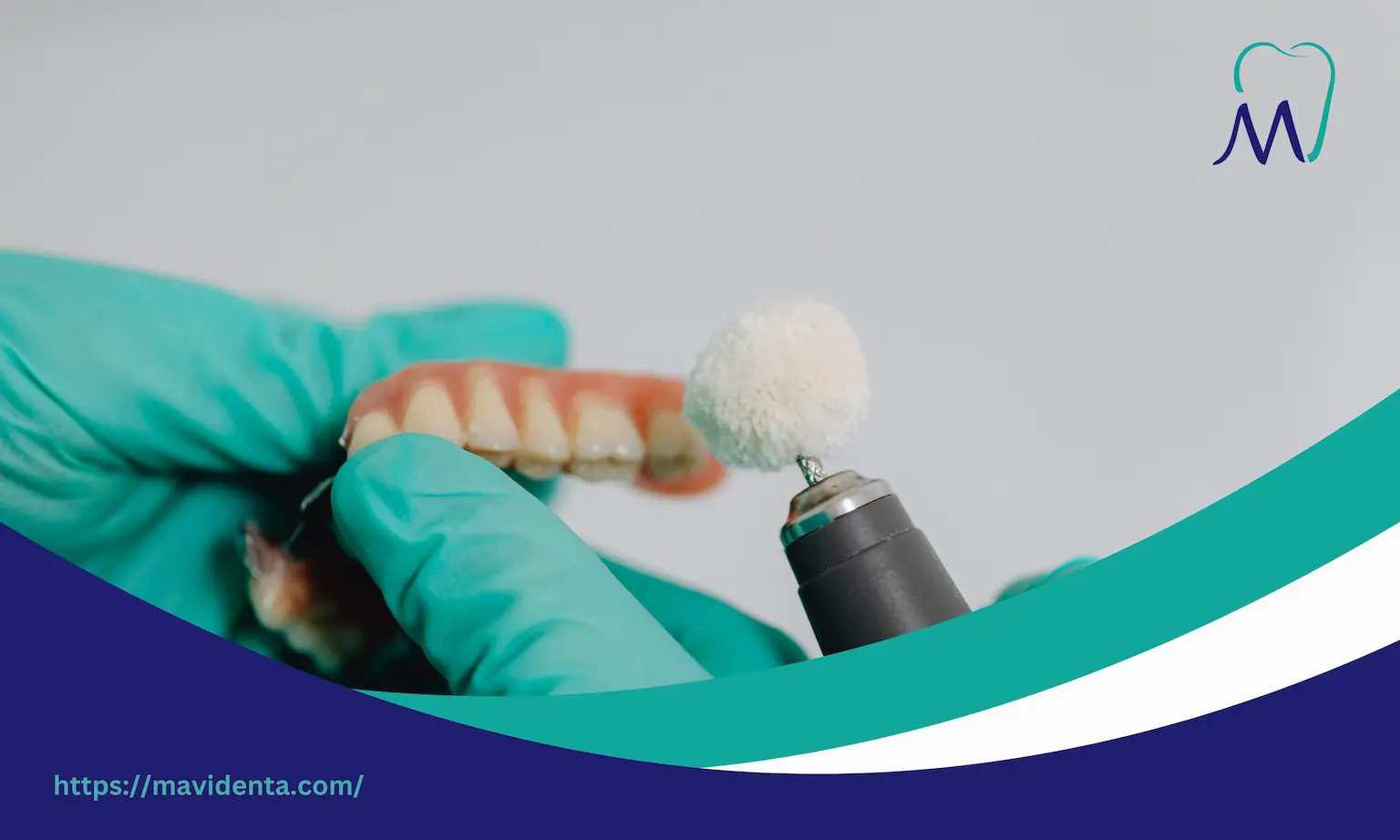 dental implants for missing lateral incisors