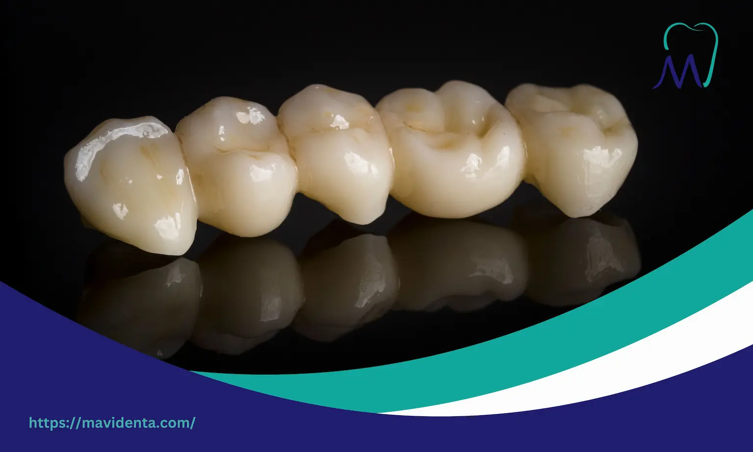 Цена несъёмного моста из диоксида циркония