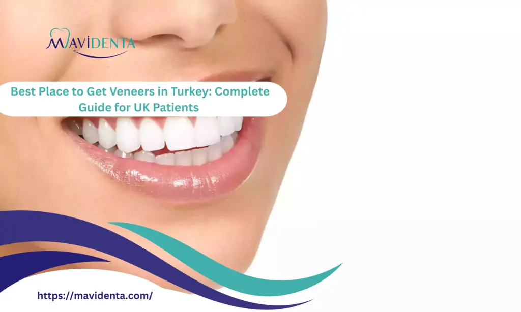 Best Place to Get Veneers in Turkey