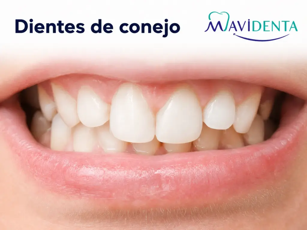 Dientes de conejo