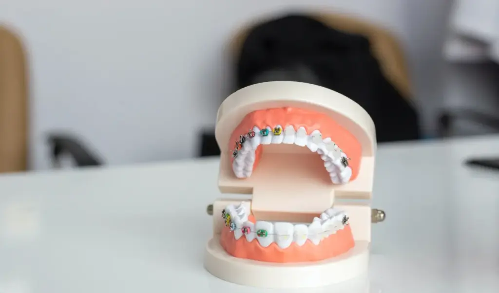 How to Fix Open Bite Treatment Options