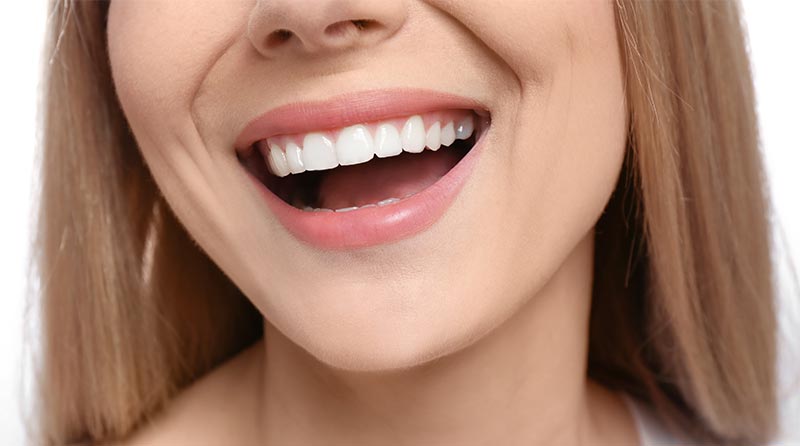 How to Get Perfect Teeth
