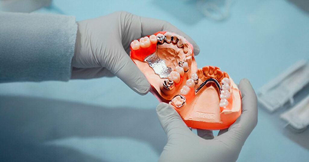 Prótesis dental inferior