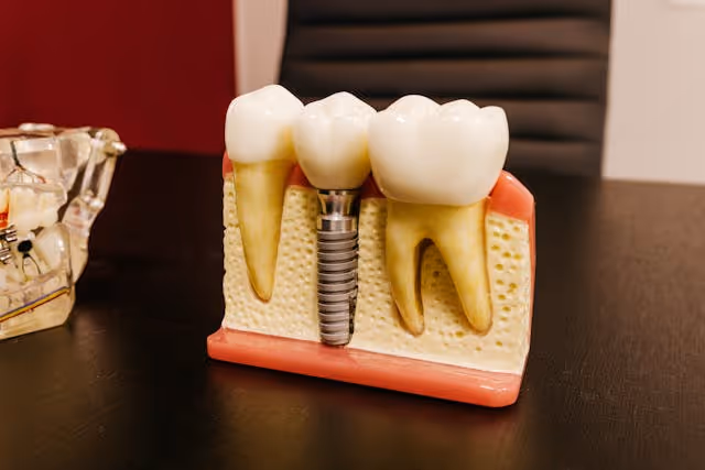 Dental Implants for Diabetics