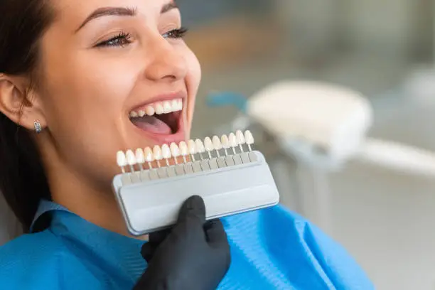 Las carillas dentales parecen naturales
